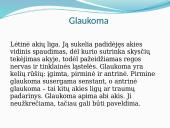 Glaukoma. Slaugos veiksmai 2 puslapis
